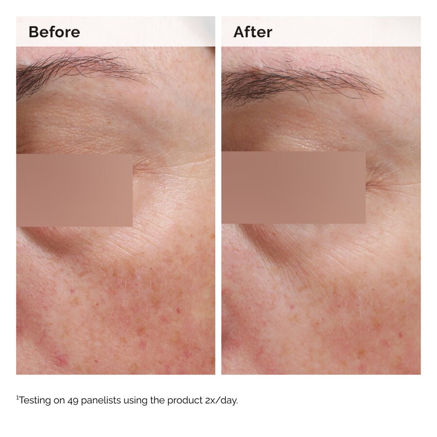 niacinamide-5-face-and-body-emulsion-c5 2024-08-23-ORD-Nia-5pct-Face-Body-B-A-Elasticity-Global-02-1x1.jpg