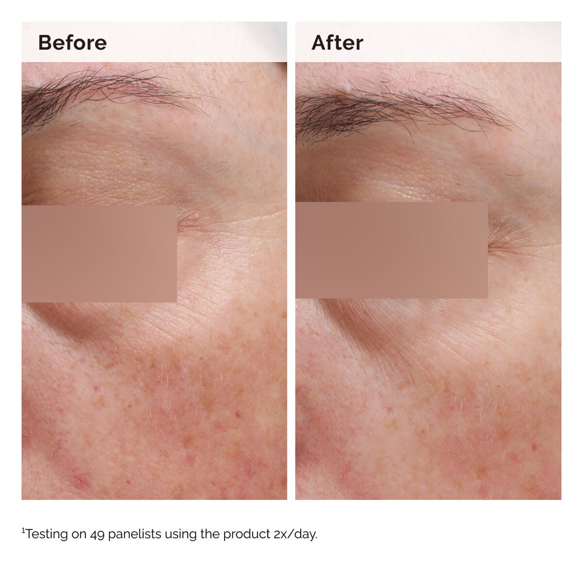 niacinamide-5-face-and-body-emulsion-c5 2024-08-23-ORD-Nia-5pct-Face-Body-B-A-Elasticity-Global-02-1x1.jpg