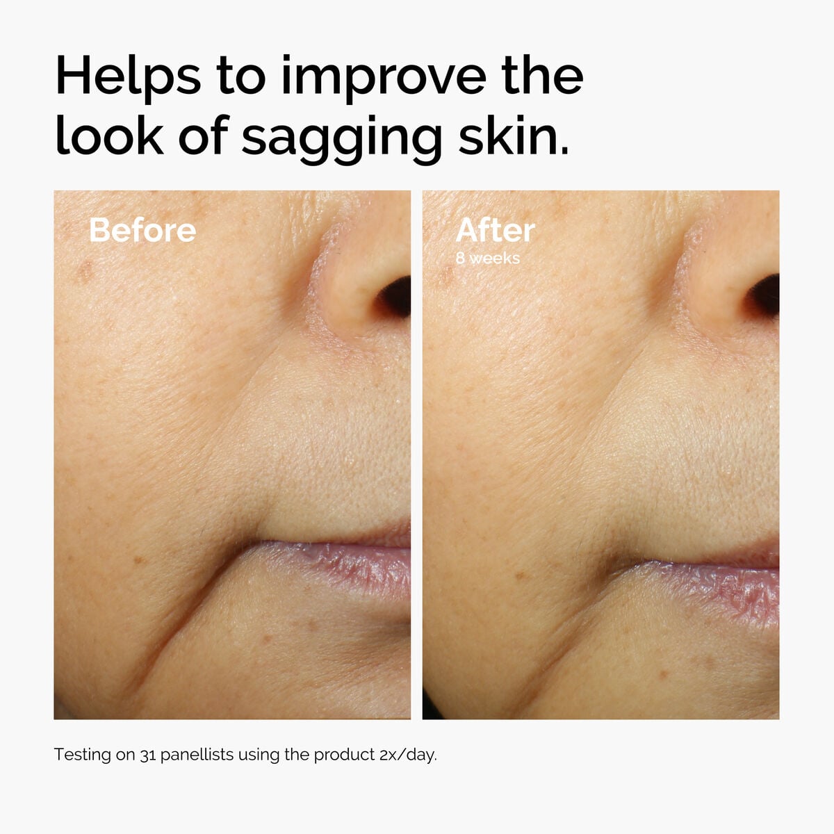 caffeine-3-escin-1-face-serum-g6 ord-caffeine-3pct-escin-1pct-face-serum-before-after-sagging.jpg