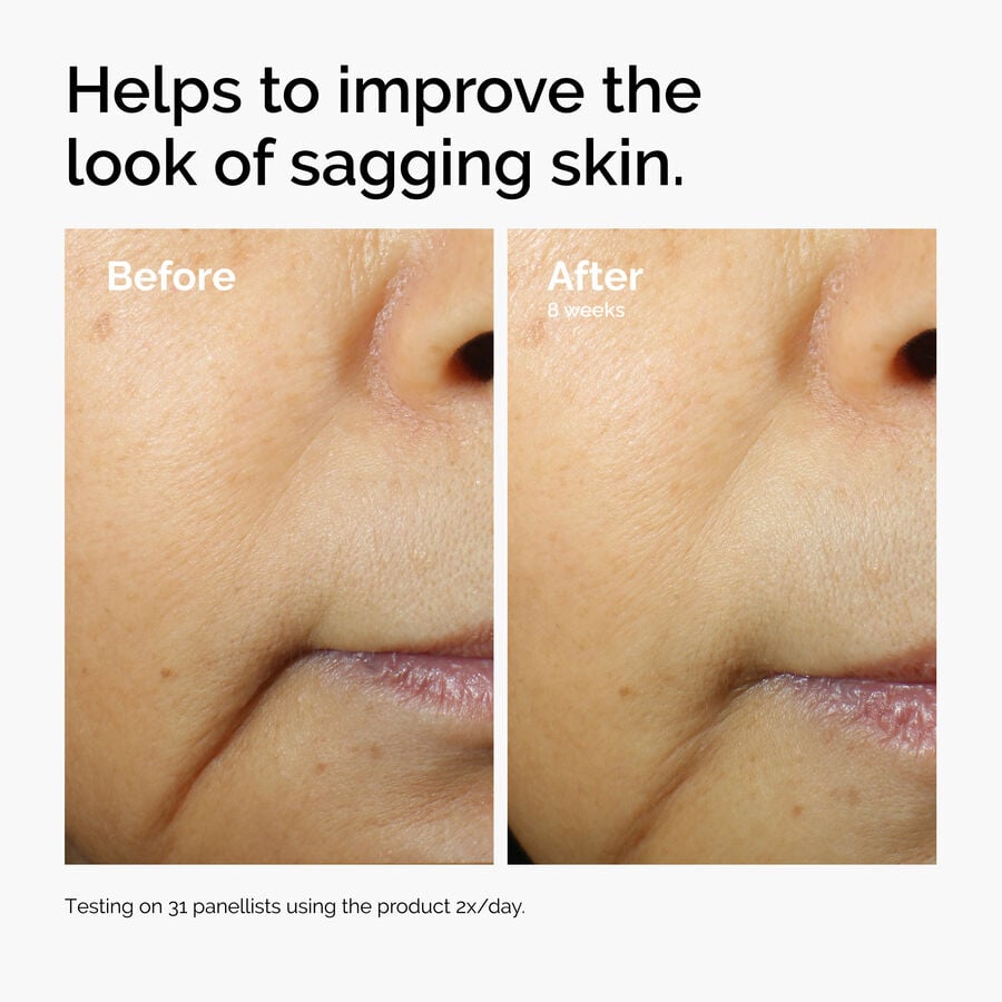 caffeine-3-escin-1-face-serum-g6 ord-caffeine-3pct-escin-1pct-face-serum-before-after-sagging.jpg
