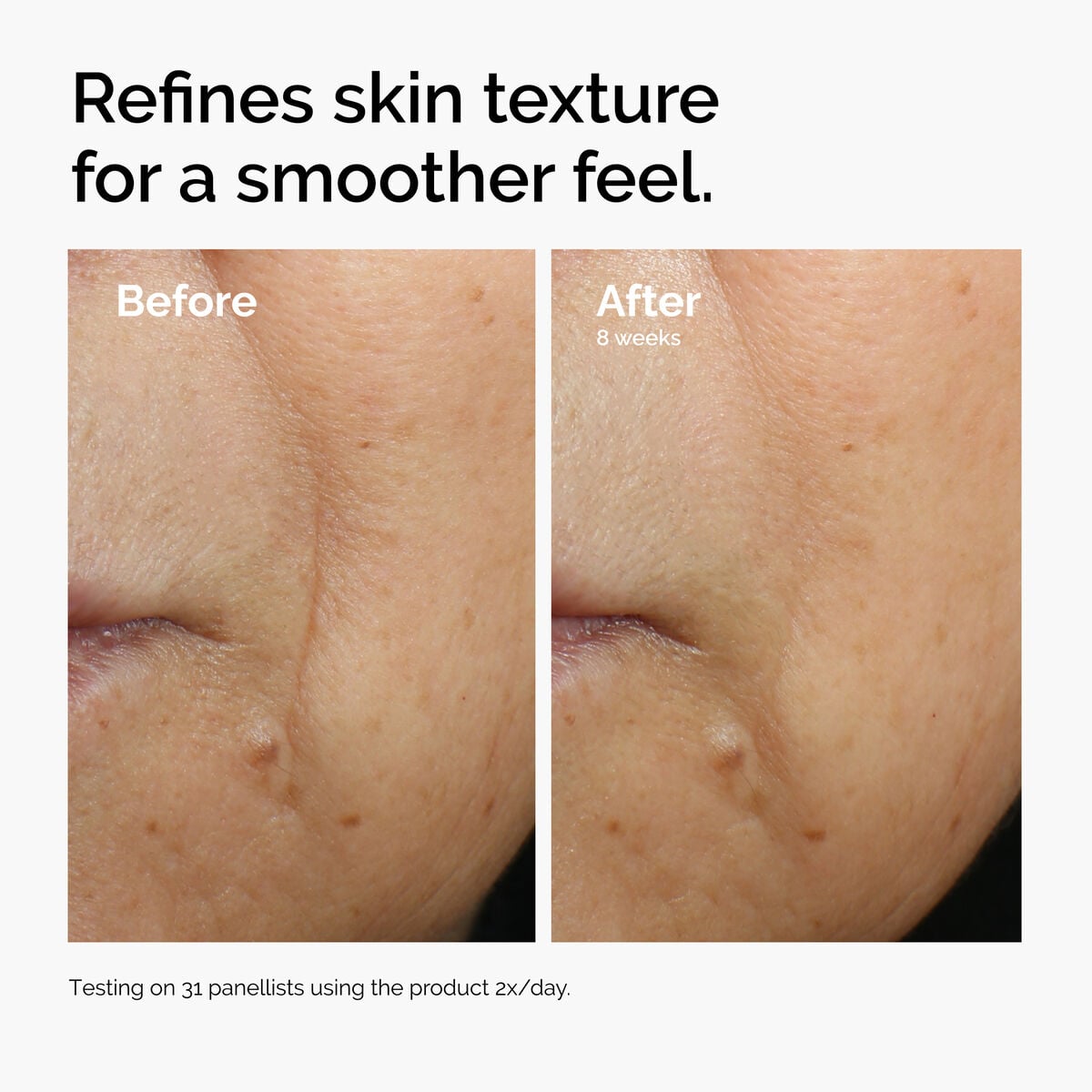 caffeine-3-escin-1-face-serum-g6 ord-caffeine-3pct-escin-1pct-face-serum-before-after-texture.jpg