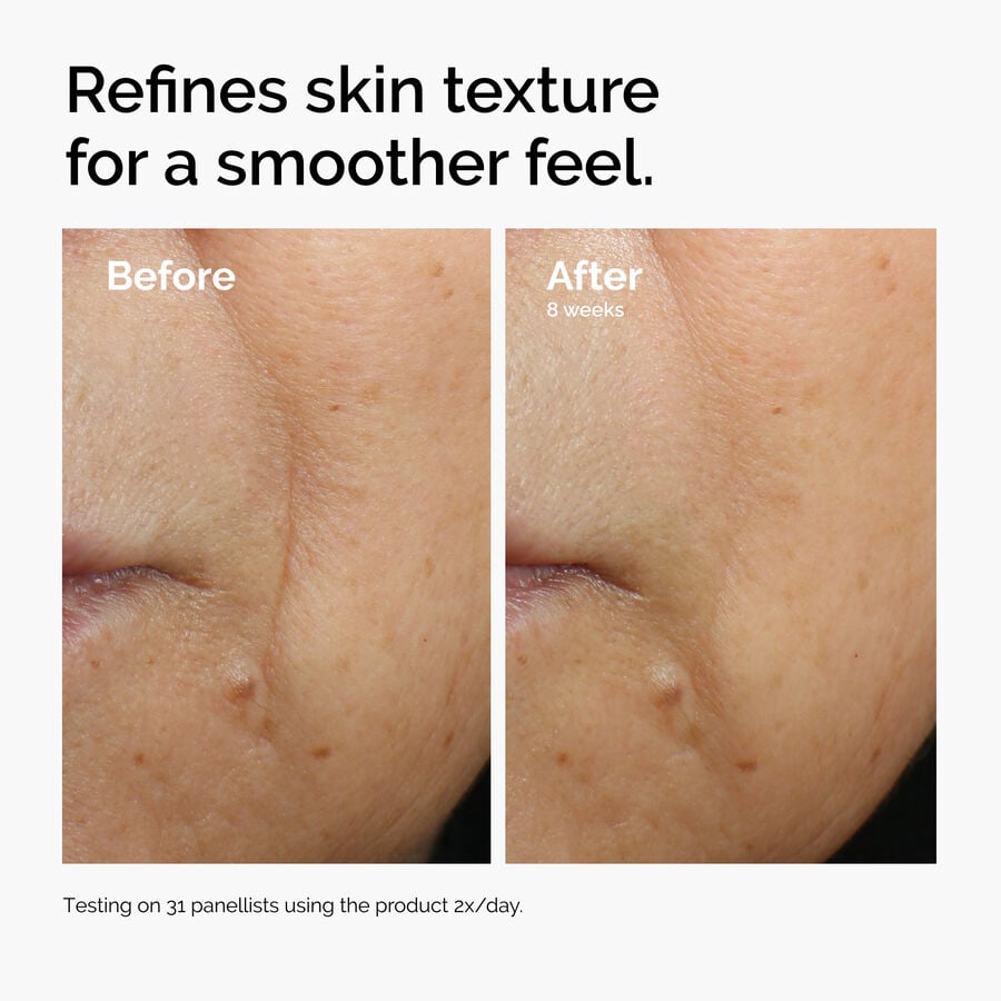 caffeine-3-escin-1-face-serum-g6 ord-caffeine-3pct-escin-1pct-face-serum-before-after-texture.jpg