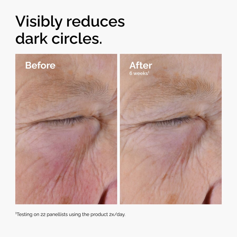 caffeine-solution-5-egcg-eye-serum-r6 ord-caffeine-solution-egcg-dark-circles-before-after.jpg