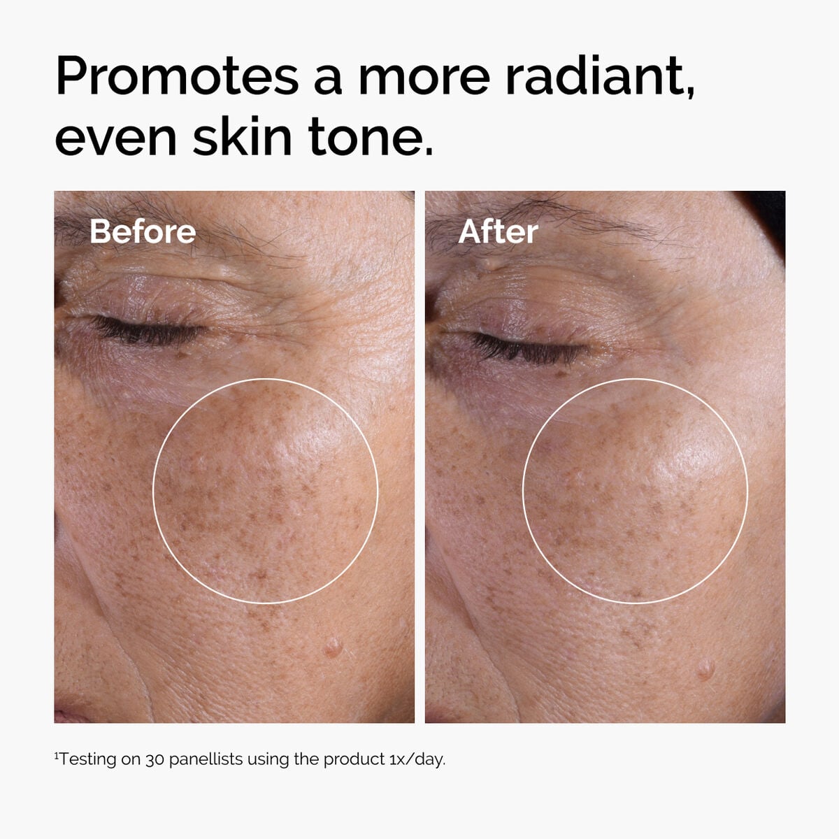 glycolic-acid-7-exfoliating-toner-f6 ord-glycolic-before-after-radiance.jpg