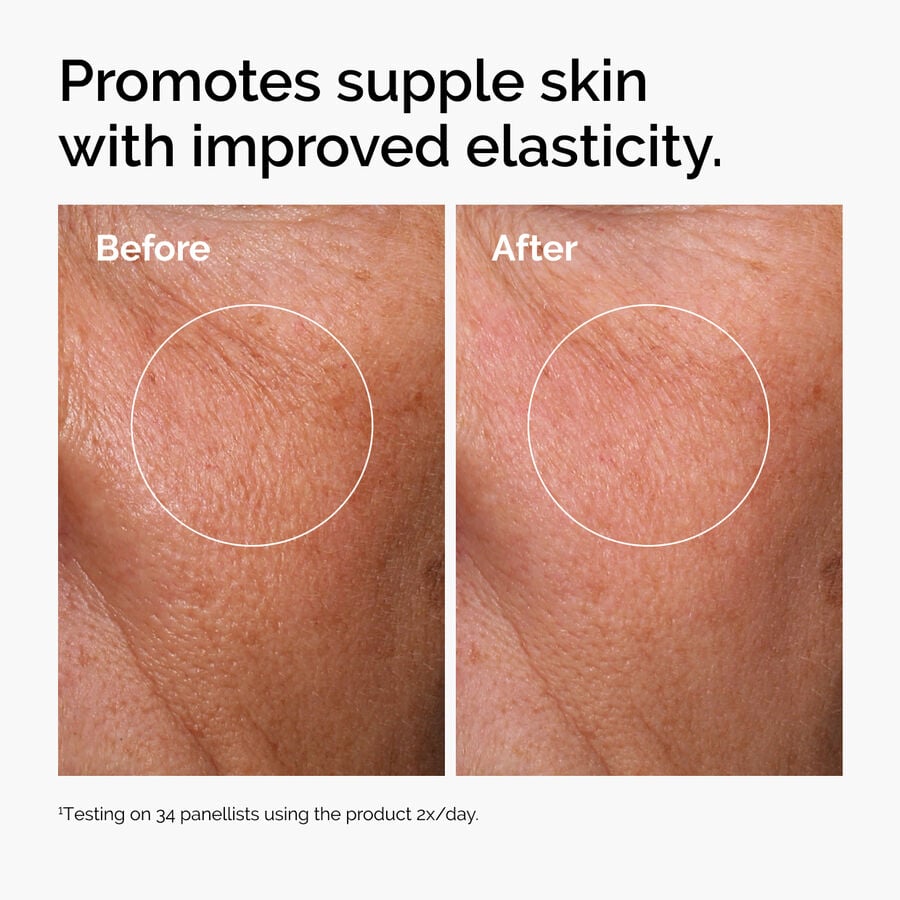 hyaluronic-acid-2-b5-with-ceramides-n8 ord-hyaluronic-acid-2pct-b5-hydrating-serum-before-after-elasticity.jpg