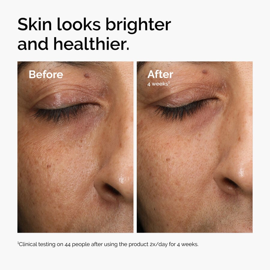 multi-antioxidant-radiance-serum-y7 ord-mars-before-after-healthy.jpg