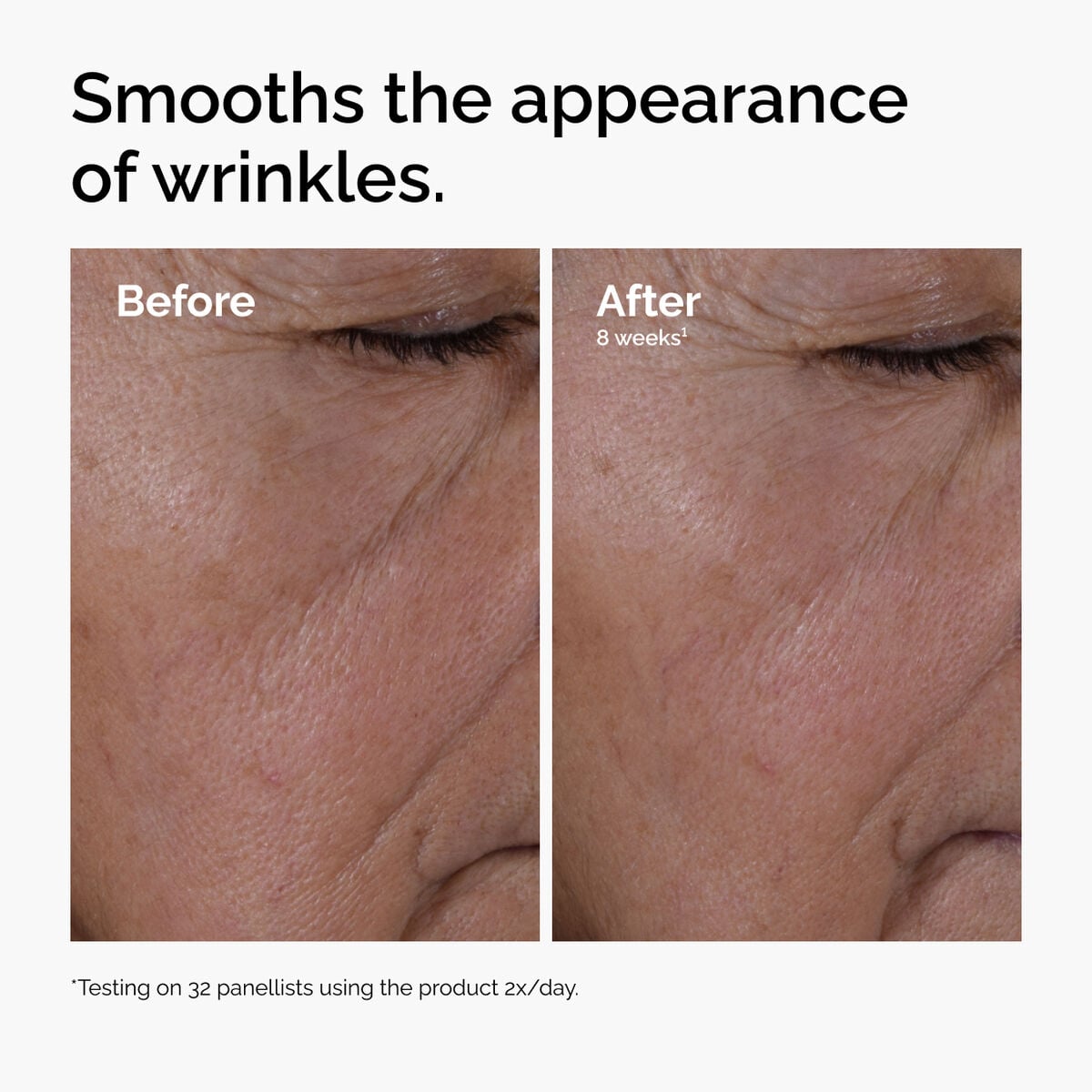 multi-peptide-ha-serum-t3 ord-multi-peptide-ha-serum-wrinkles-before-after.jpg