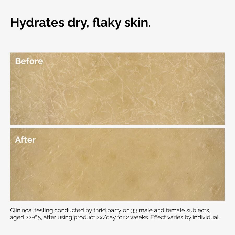 the-body-care-collection-h5 ord-natural-moisturizing-factors-inulin-body-before-after-graphic-02.jpg