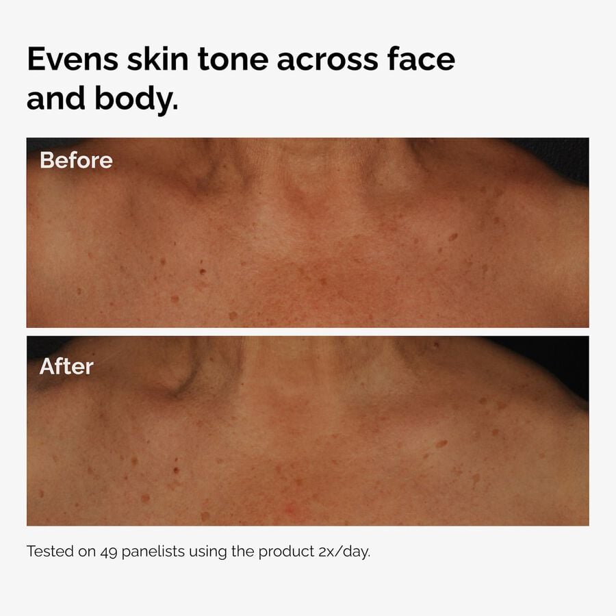 the-body-care-collection-h5 ord-niacinamide-face-body-serum-before-after-even-tone-graphic.jpg