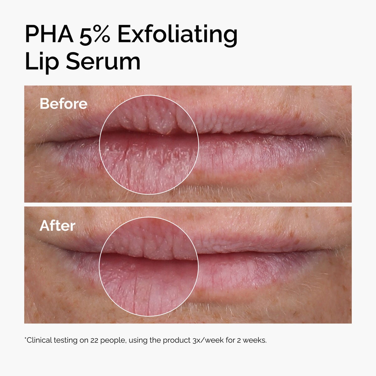 pha-5-exfoliating-lip-serum-c0 ord-pha-5pct-lip-exfoliating-serum-before-after.jpg