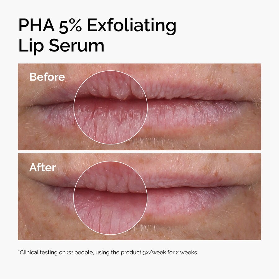 pha-5-exfoliating-lip-serum-c0 ord-pha-5pct-lip-exfoliating-serum-before-after.jpg